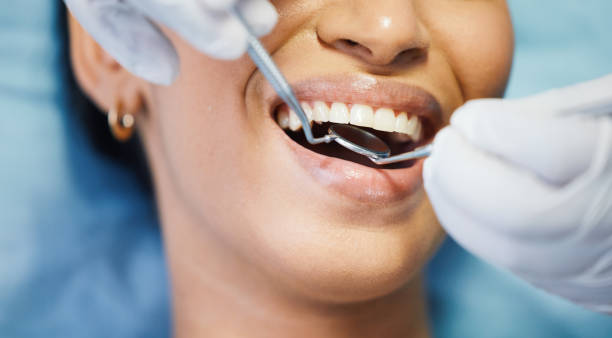 Best Emergency Wisdom Teeth Removal in Hamlin, TX
